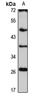 CLEC-6 Rabbit Polyclonal Antibody