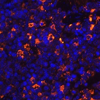 CLEC-6 Rabbit Polyclonal Antibody