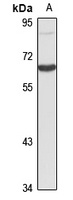 Epsin 4 Rabbit Polyclonal Antibody