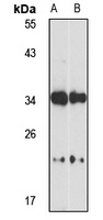 CLN8 Antibody