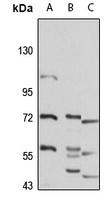 HSP78 Rabbit Polyclonal Antibody