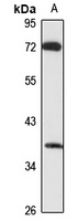 RLBP1L2 Rabbit Polyclonal Antibody