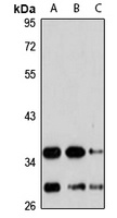 Chymase Rabbit Polyclonal Antibody