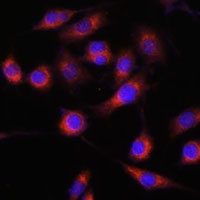 Anti-GPBP Antibody