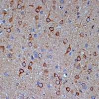 Anti-COPG2 Antibody