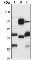 Coronin-2A Rabbit Polyclonal Antibody