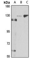 Ceruloplasmin Rabbit Polyclonal Antibody