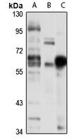 CPEB Rabbit Polyclonal Antibody