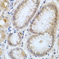 Anti-Carboxypeptidase M Antibody