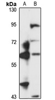 CRE-Bpa Rabbit Polyclonal Antibody