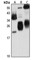 CRIP2 Rabbit Polyclonal Antibody