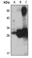 Beta-B2 crystallin Rabbit Polyclonal Antibody