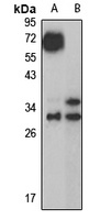 Gamma-D crystallin Rabbit Polyclonal Antibody