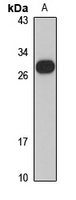 Beta-casein Rabbit Polyclonal Antibody