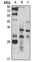 LMO5 Rabbit Polyclonal Antibody