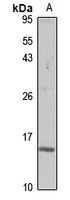 Cystatin 2 Rabbit Polyclonal Antibody