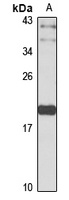 CTAG1B Antibody