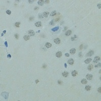 Anti-CTAG1B Antibody