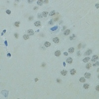 CTAG1B antibody