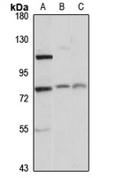 CTAGE1 Antibody