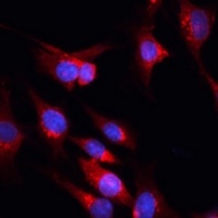 Anti-CUX1 Antibody