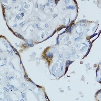 Anti-Cytochrome P450 19A1 Antibody