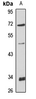 Cytochrome P450 19A1 Rabbit Polyclonal Antibody