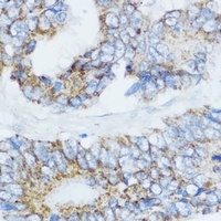 Anti-Cytochrome P450 19A1 Antibody
