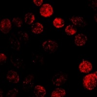 Anti-Cytochrome P450 19A1 Antibody