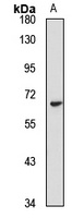 CYP27B1 Rabbit Polyclonal Antibody