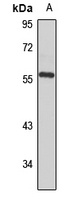 Cytochrome P450 4B1 Rabbit Polyclonal Antibody