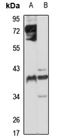 CYR61 Antibody