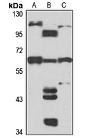 DAK Rabbit Polyclonal Antibody