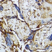 Anti-DAP Kinase 3 Antibody