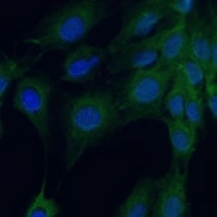 Anti-DAP Kinase 3 Antibody