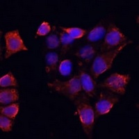 Anti-DAZL Antibody
