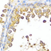 Anti-DAZL Antibody