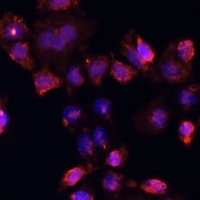 Anti-DAZL Antibody