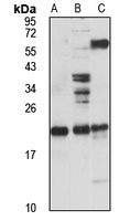 Dynactin 5 Rabbit Polyclonal Antibody