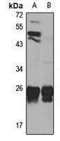 Dynactin 6 Rabbit Polyclonal Antibody
