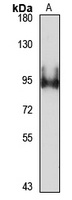 DDX31 Antibody