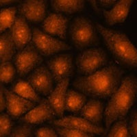 Anti-DDX31 Antibody