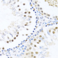 DDX46 antibody