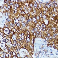 RCK antibody