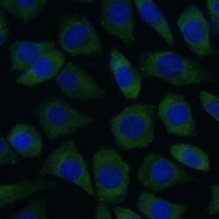Anti-RCK Antibody