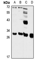 DECR1 Antibody