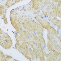 Anti-DENR Antibody
