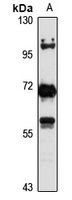 DEPDC7 Rabbit Polyclonal Antibody