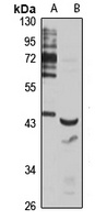 DEPTOR Rabbit Polyclonal Antibody