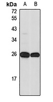 DGCR6L Antibody